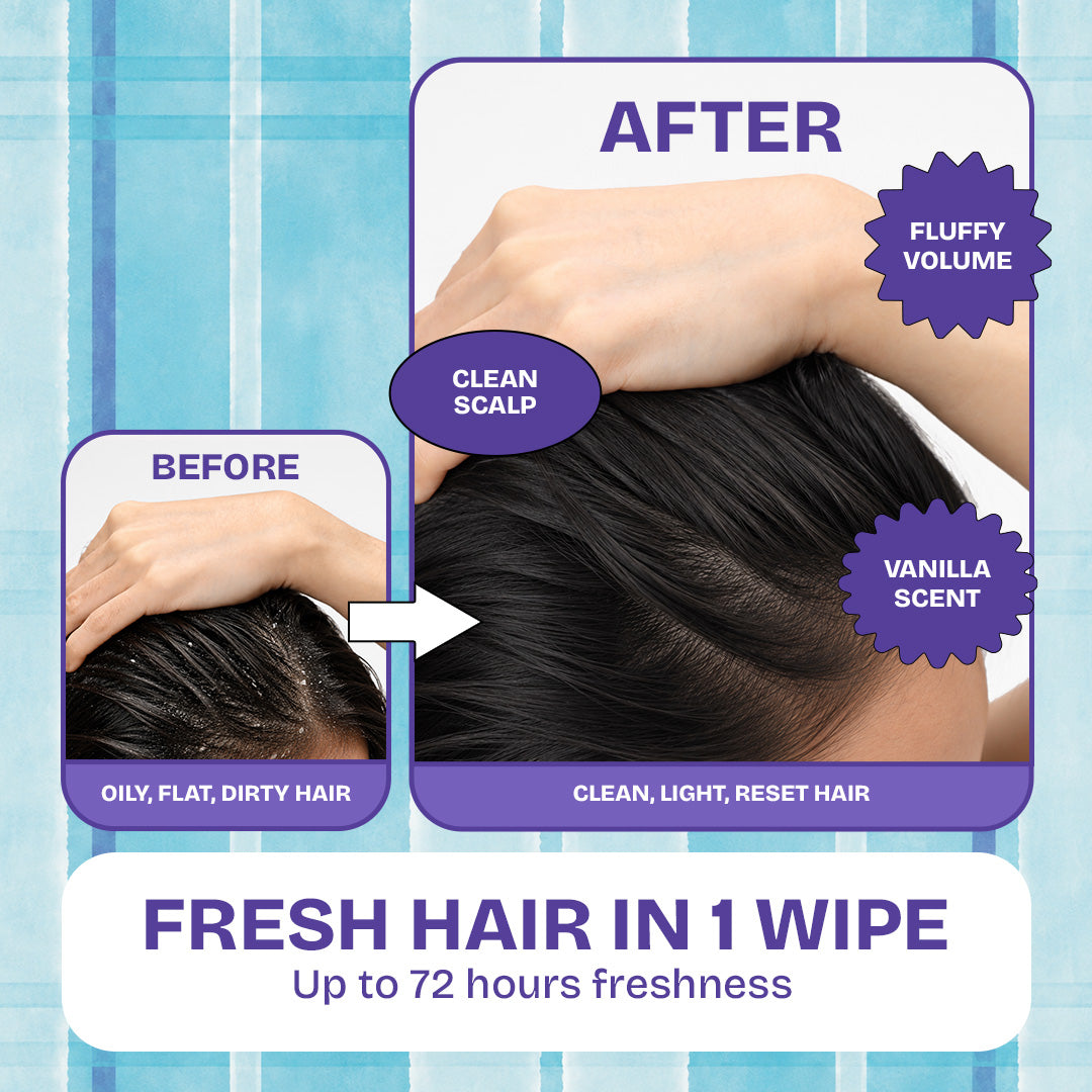 B/YOND Hair Reset Dry Shampoo Towel 10pcs | Wipes Dirt, Sweat & Oil | Anti-Dandruff Bimpo Panyo